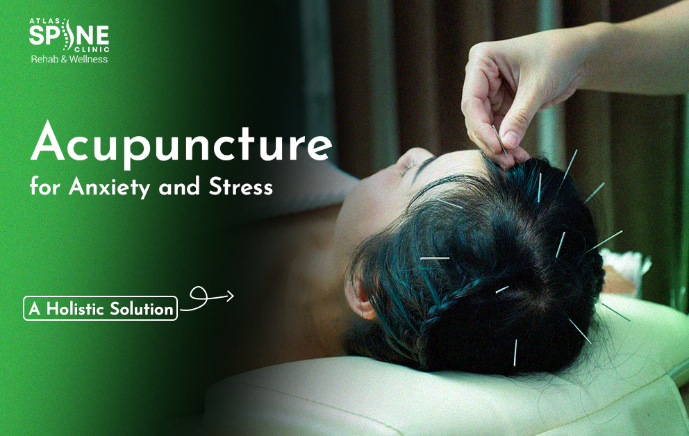 Acupuncture for Anxiety