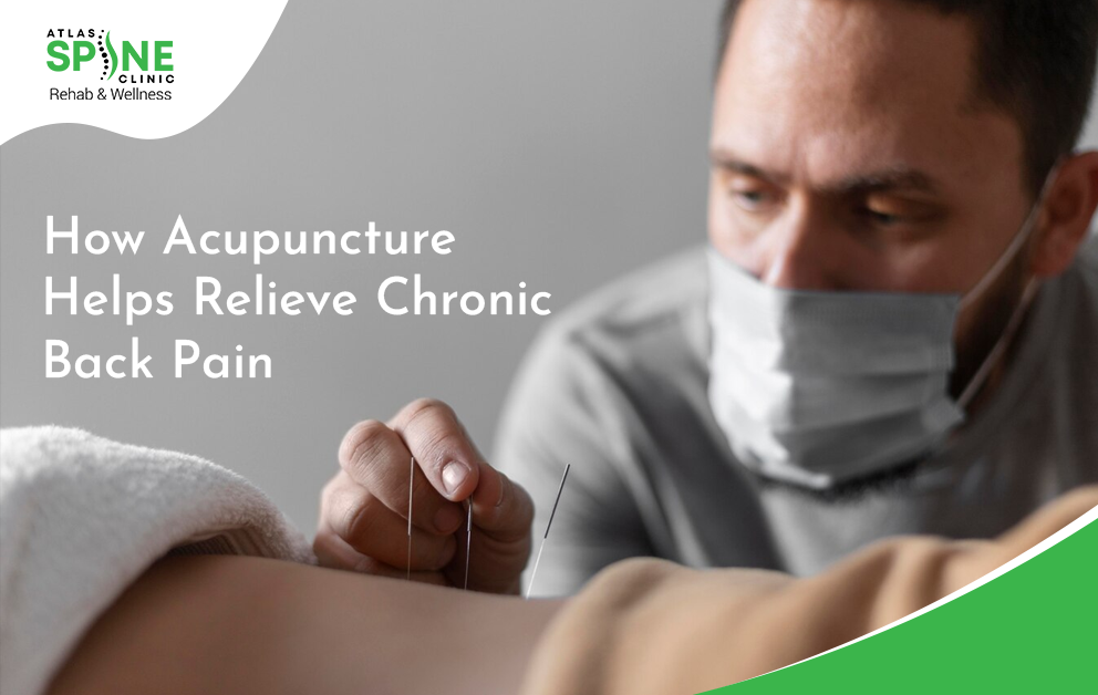 acupuncture help back pain