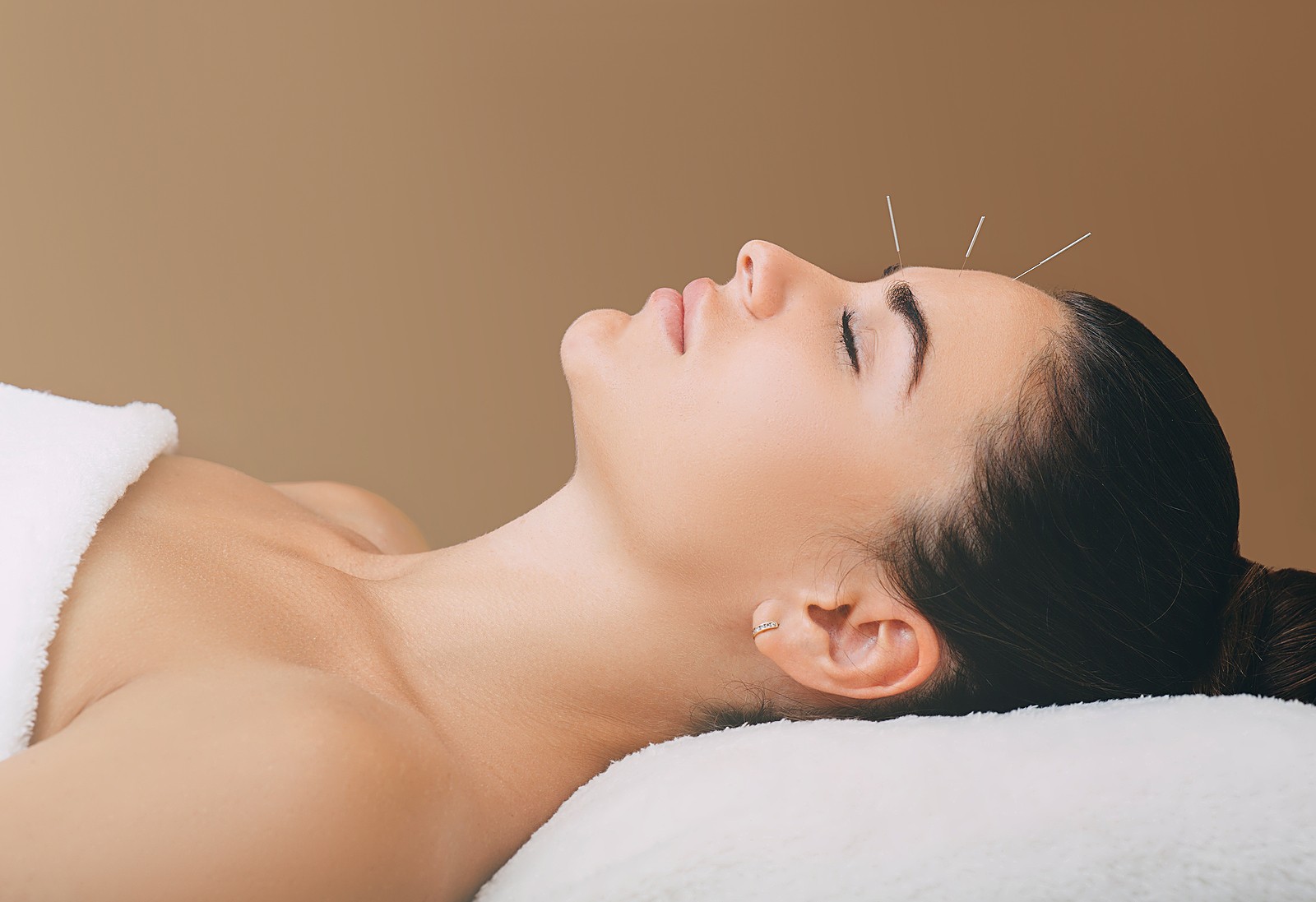 How Acupuncture Can Help with Stress and Anxiety