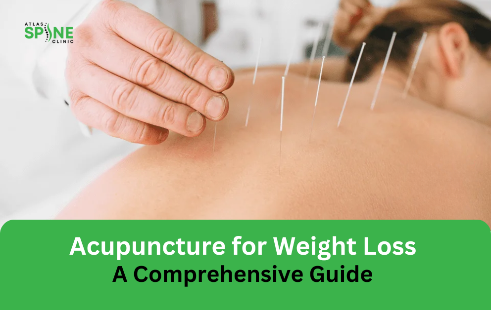 acupuncture for weight loss