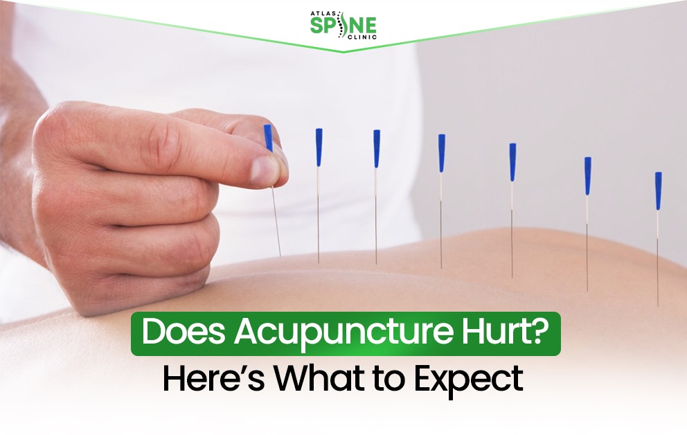 does acupuncture hurt