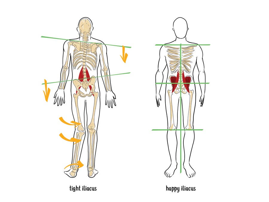 Fix Uneven Hips 