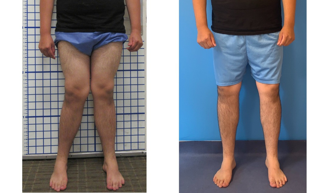  Knee Health