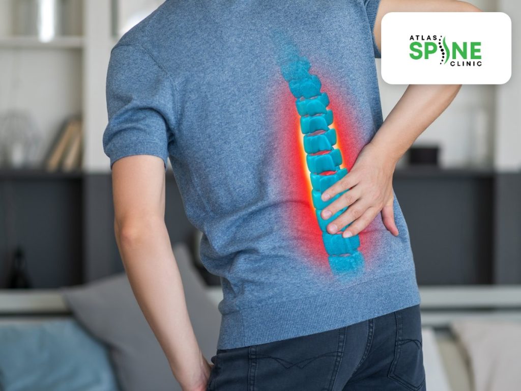 Illustration of the lumbar spine with the lower vertebrae highlighted, showing the nerve compression that causes sciatica, at Atlas Spine Clinic in Scarborough