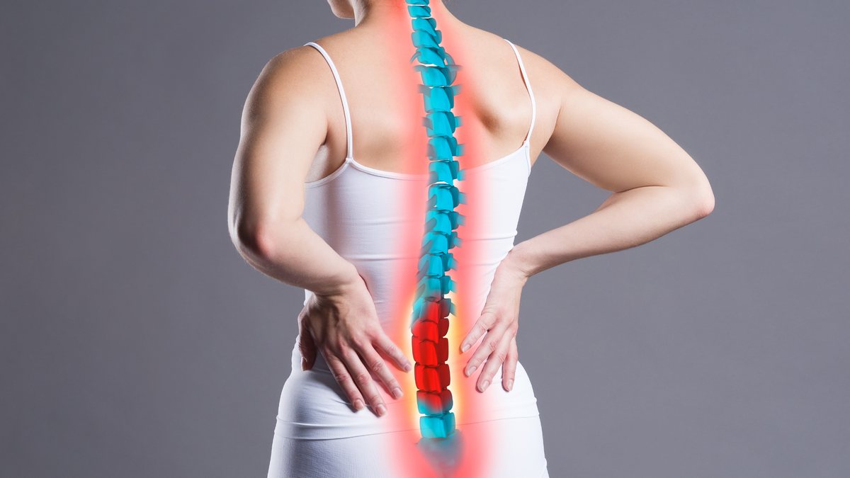 Illustration of the lumbar spine with the lower vertebrae highlighted, showing the nerve compression behind sciatica